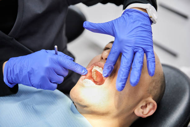 Best Emergency Denture Repair in Kettering, MD