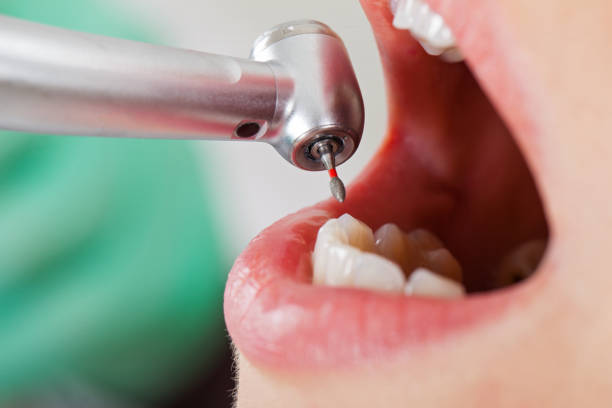 Best Emergency Dental Care for Sports Injuries in Kettering, MD